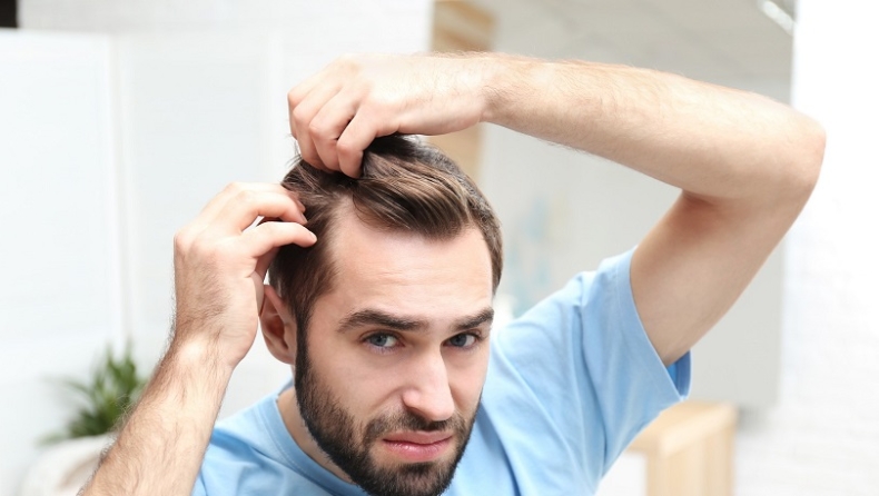 Τριχόπτωση: Όσα πρέπει να γνωρίζετε