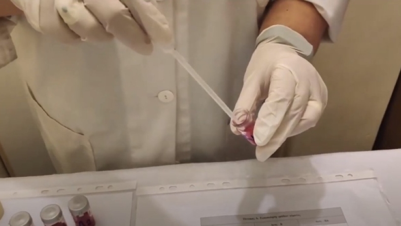 Τα 10 σημαντικότερα «Σαν Σήμερα»: Η πρώτη μετάγγιση αίματος 