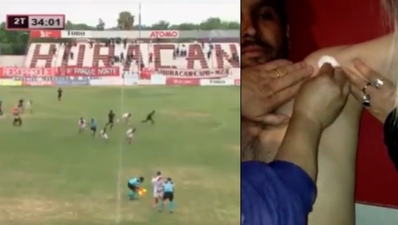 Αργεντινή: Προπονητής πυροβολήθηκε σε αγώνα 3ης κατηγορίας κατά τη διάρκεια επεισοδίων (vids)