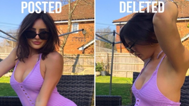 Influencer αποκαλύπτει πώς κρύβει στο Instagram τις ατέλειες του σώματός της