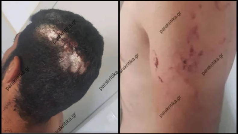  Του ζήτησε τον μισθό του και κόντεψε να τον αφήσει στον τόπο με αλυσίδα