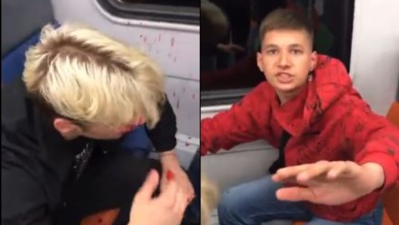 Τρομακτικό βίντεο από τη Μόσχα: Φασίστας χτυπάει άγρια νεαρό που έχει σκουλαρίκι στη μύτη, έτρεμε ο φίλος του από τον φόβο του (vid)