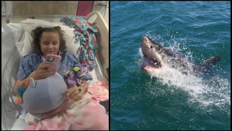 Καρχαρίας επιτέθηκε σε 10χρονη: Την δάγκωσε, τον κλώτσησε και κατάφερε να γλιτώσει (vid)