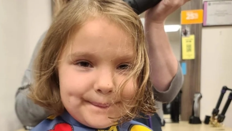 Σκυλί δάγκωσε 6χρονη στο πρόσωπο: Χρειάστηκε πάνω από 1.000 ράμματα