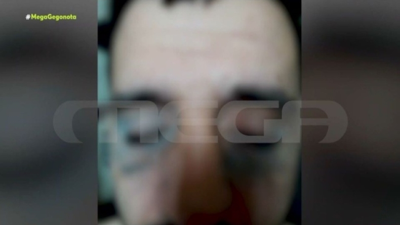 «Μάνα σώσε με γιατί με σκοτώνουν»: Άγριος βασανισμός 33χρονου κρατούμενου από αστυνομικούς (vid)