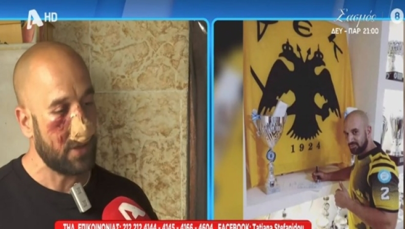 Ο 36χρονος αθλητής της ΑΕΚ που έπεσε θύμα ξυλοδαρμού: «Κατάλαβα ότι πρόκειται για οπαδούς του Ολυμπιακού» (vid)