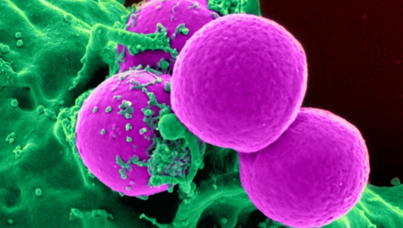 Τι είναι η βακτηριακή λοίμωξη που έστειλε τη Μαντόνα στην εντατική - Οι αιτίες και τα συμπτώματα