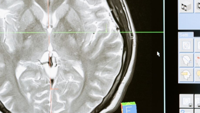 Κάνε το τεστ και βρες την ηλικία που έχει ο εγκέφαλος σου