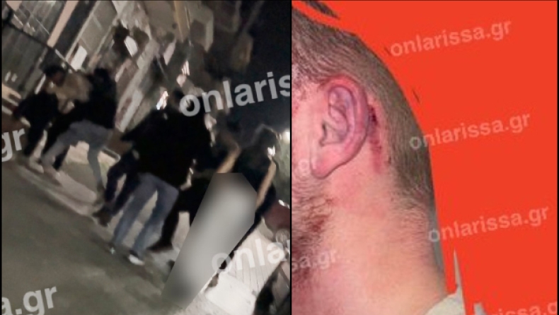 Σοκάρουν οι εικόνες από τον άγριο ξυλοδαρμό νεαρού στο κέντρο της Λάρισας (vid)