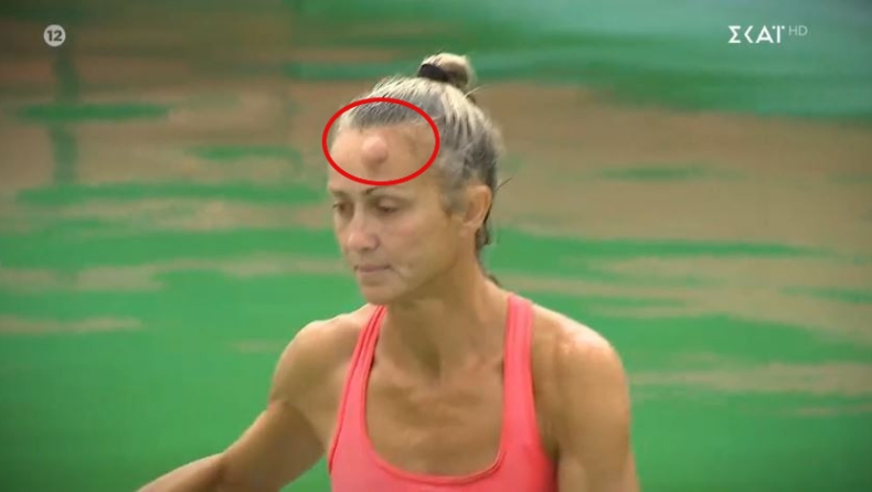 Σοκαριστική σύγκρουση στο Survivor: Αδιανόητο καρούμπαλο στο κεφάλι Μαχήτριας (vid)
