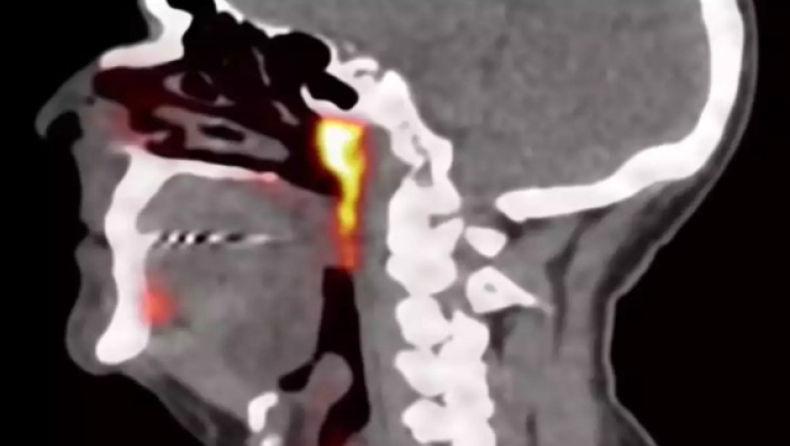 Οι επιστήμονες ανακάλυψαν τυχαία ένα νέο όργανο στο ανθρώπινο σώμα που δεν είχε παρατηρηθεί ποτέ πριν!