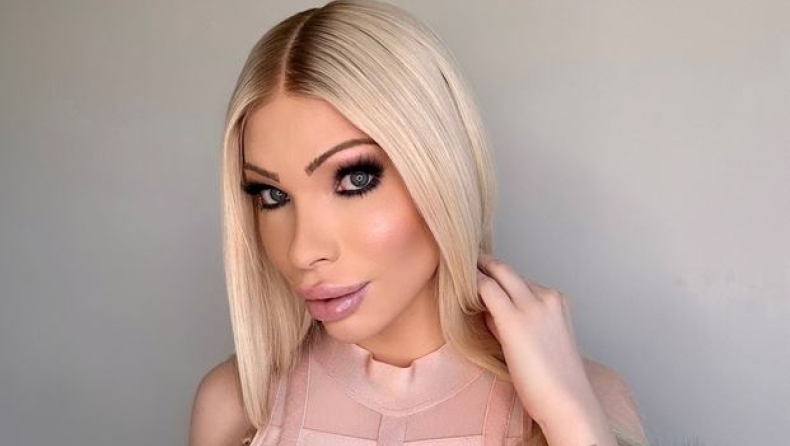 Ξόδεψε 50.000$ για να μεταμορφωθεί σε «πραγματική Barbie» και τώρα προσπαθεί να γίνει και πάλι φυσική (vid)