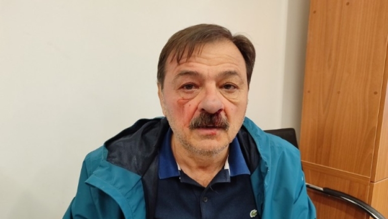 Μασκοφόρος ξυλοκόπησε δημοτικό σύμβουλο στον Βόλο: Τον κυνήγησαν και έπαθαν... πλάκα όταν του έβγαλαν την κουκούλα