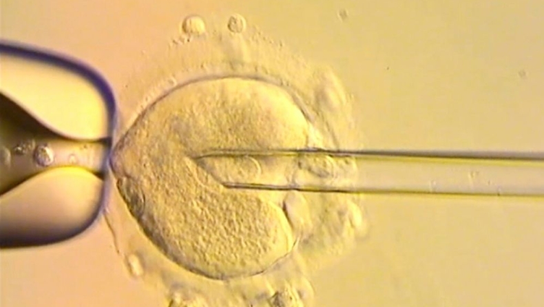 Γεννήθηκαν μωρά με DNA τριών ατόμων στη Βρετανία: Είναι απαλλαγμένα από μιτοχονδριακά νοσήματα