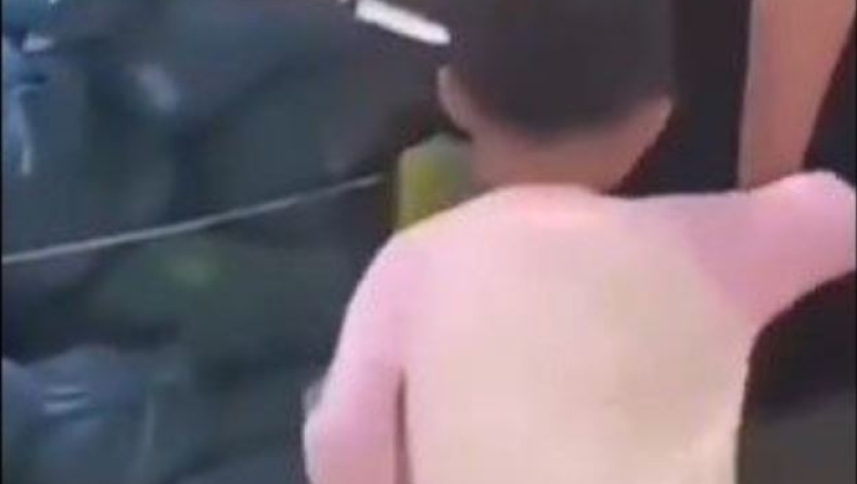 Κίνα: Τρίχρονη πήγε στο νοσοκομείο με μαχαίρι καρφωμένο στο κεφάλι (vid)