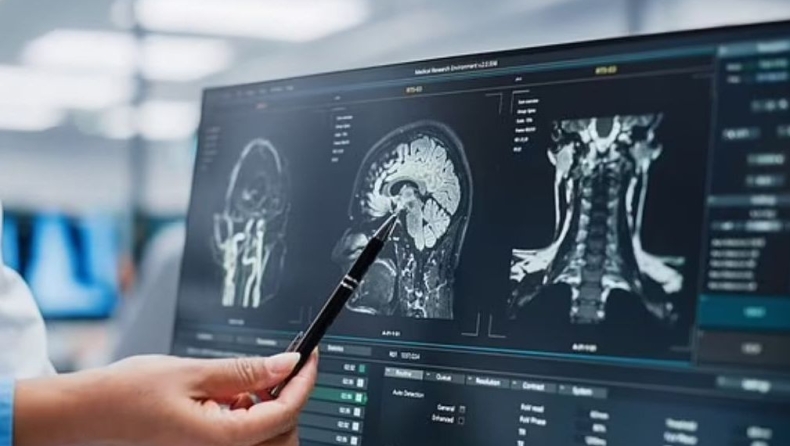 Ποιες είναι οι πέντε «εποχές» του εγκεφάλου: Σε ποια δεκαετία «ενηλικιωνόμαστε»