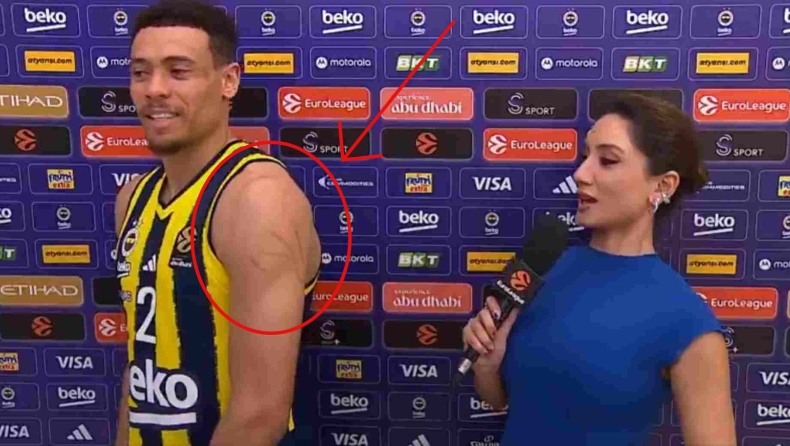 Ο Μπόλντγουιν έδειξε στην κάμερα τις γρατζουνιές στο σώμα του: «Αυτό είναι το παιχνίδι του Ολυμπιακού» (vid)