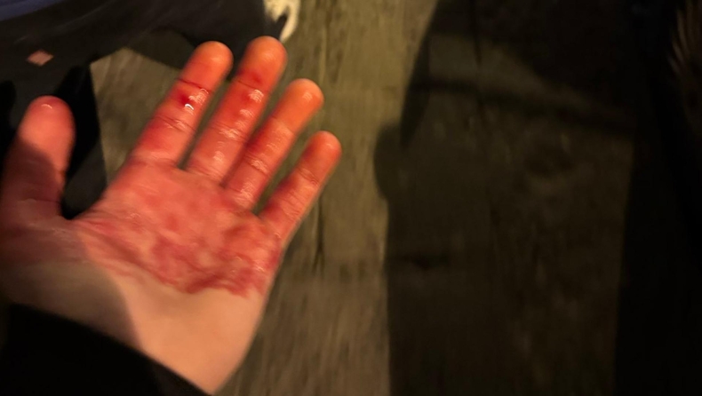 Τσέλσι: Δυο οπαδοί της μαχαιρώθηκαν από ultras στη Νάπολη