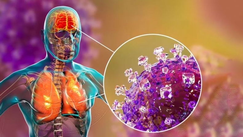 Συναγερμός για τον ιό Nipah: Πώς μεταδίδεται και ποια είναι τα συμπτώματα