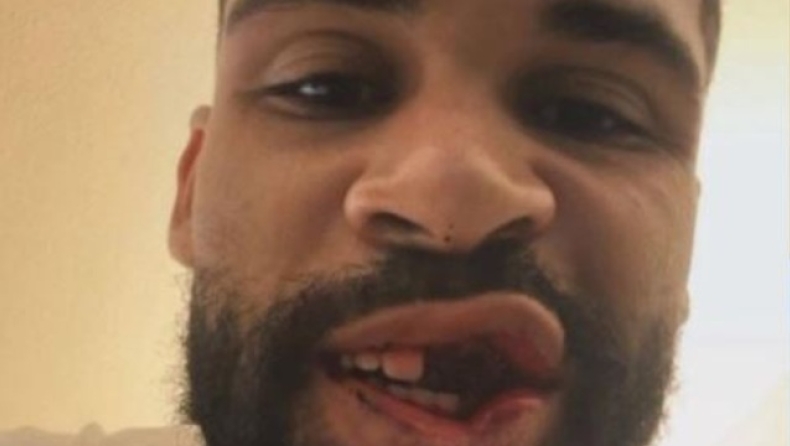 Λόφτους Τσικ: Το συγκινητικό μήνυμα μετά το χειρουργείο