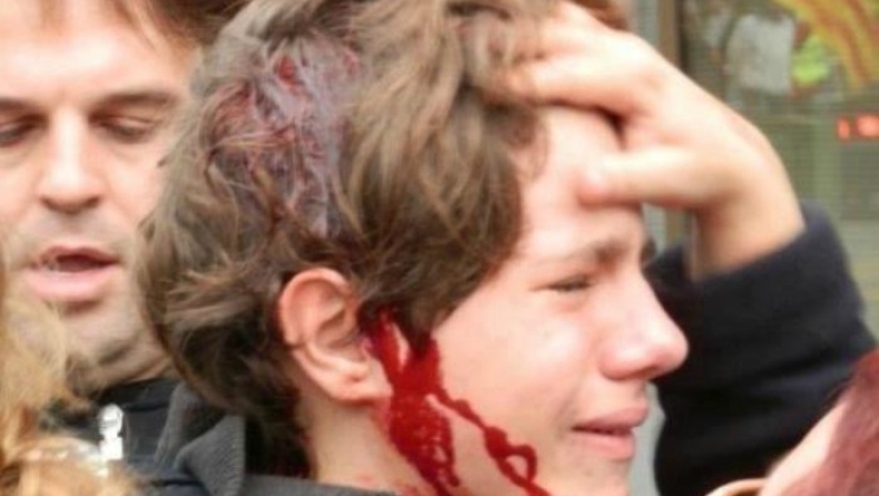 Τα ΜΑΤ στην Ισπανία τραυμάτισαν 13χρονο!