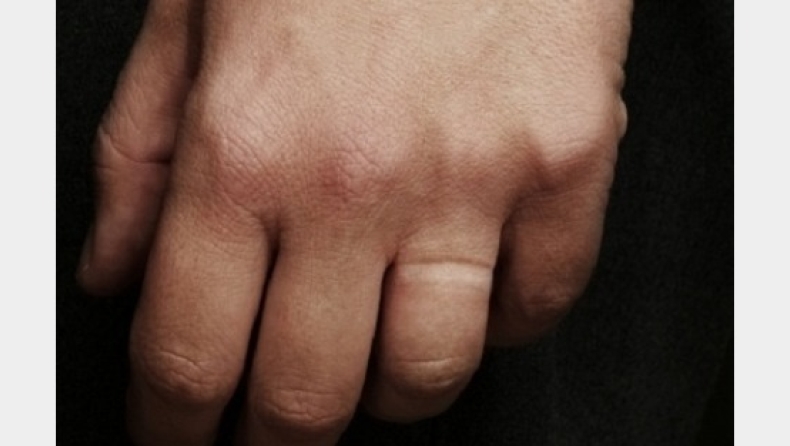 Γιατί οι άνδρες δεν φοράνε (συνήθως) τη βέρα τους;