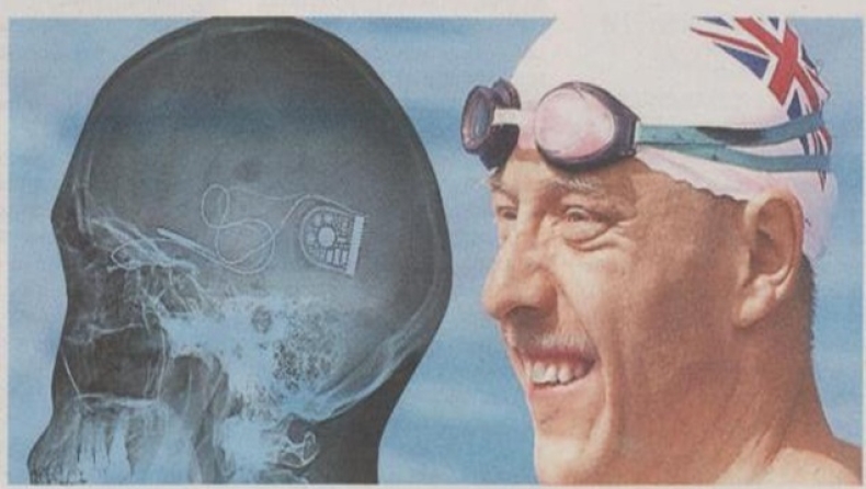 Ένα μικροτσίπ του έδωσε το φως του