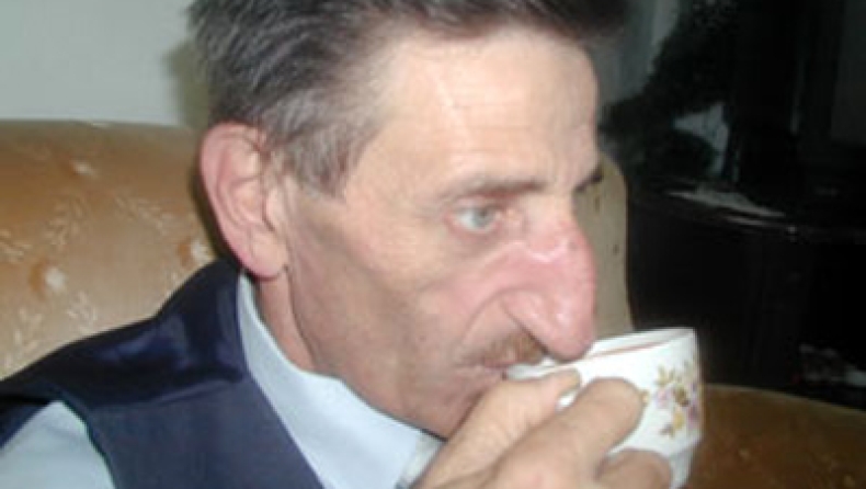 Η μεγαλύτερη μύτη στον κόσμο!