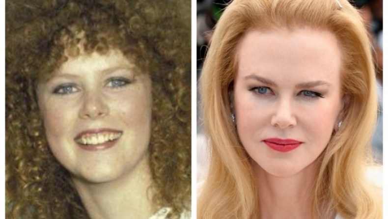 Οι πιο σοκαριστικές πλαστικές επεμβάσεις του Χόλιγουντ! (pics)