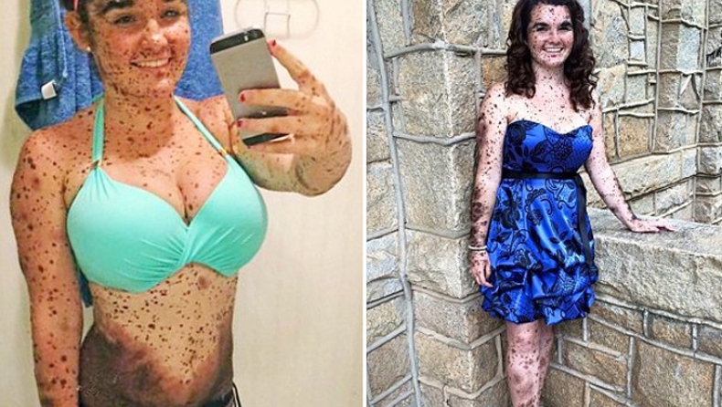 «Είμαι περήφανη που είμαι διαφορετική» (pics)