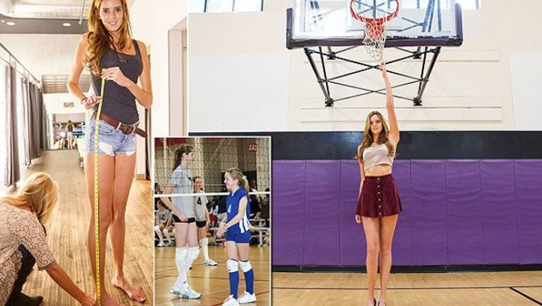 Κόπηκε απ'το μόντελινγκ επειδή είχε ψηλά πόδια (pics)