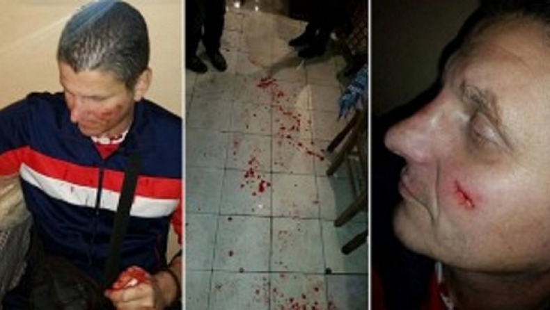 Μαχαιρώματα Σέρβων στα Σκόπια (pics)