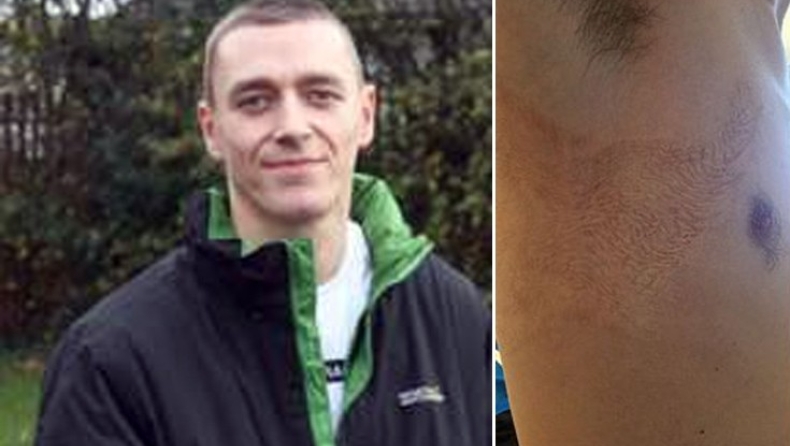 «Πώς τα 25.000 βολτ που με χτύπησαν μου άλλαξαν τη ζωή»