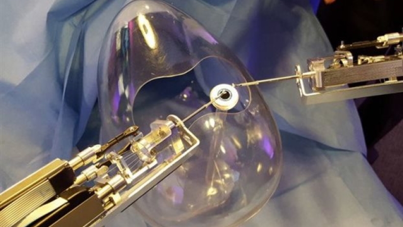 Ρομπότ κάνει επεμβάσεις ακριβείας στα μάτια!