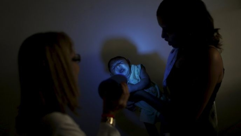 Πρώτος θάνατος βρέφους από μικροκεφαλία λόγω Ζίκα στην Αργεντινή