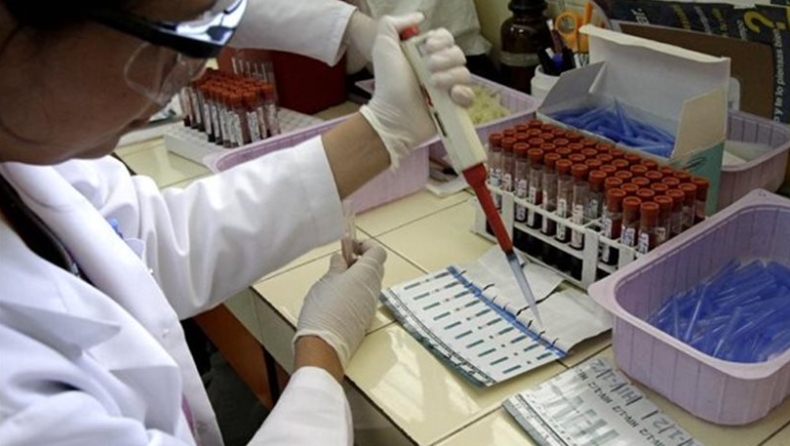 Ασθενείς με AIDS δεν μπορούν να κάνουν εξετάσεις γιατί δεν λειτουργούν τα αντιδραστήρια
