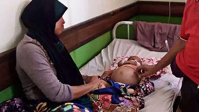 Έμβρυο 400 γραμμαρίων αφαιρέθηκε μέσα από αγοράκι 10 μηνών