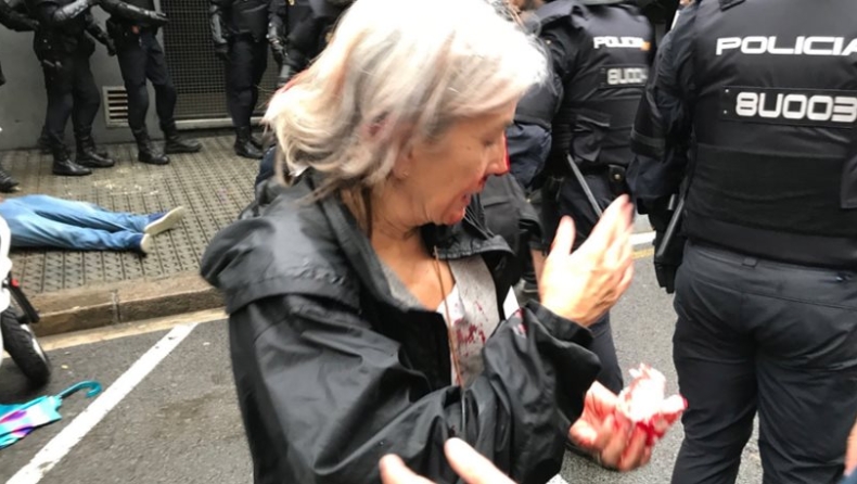 Καταλονία: 38 τραυματίες από την πρωτοφανή επίθεση της αστυνομίας στους ψηφοφόρους (pics & vids)