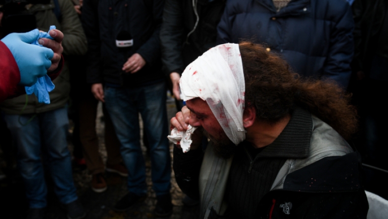 Συλλαλητήριο για τη Μακεδονία: Τραυματίστηκε φωτορεπόρτερ (vid)