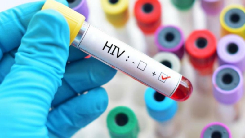 Επιστήμονες υποστηρίζουν ότι βρήκαν τρόπο να σταματήσουν τη μετάδοση του HIV