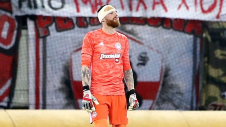 Ολυμπιακός: Το αιμάτωμα στο μάτι του Σα! (pic)