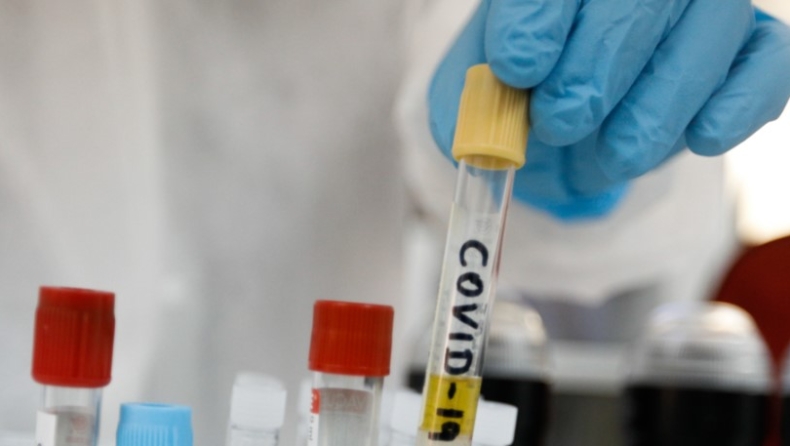 Κορονοϊός: Ποιοι έχουν προτεραιότητα στα τεστ ανίχνευσης του ιού και τι θα γίνει με τα τεστ αντισωμάτων