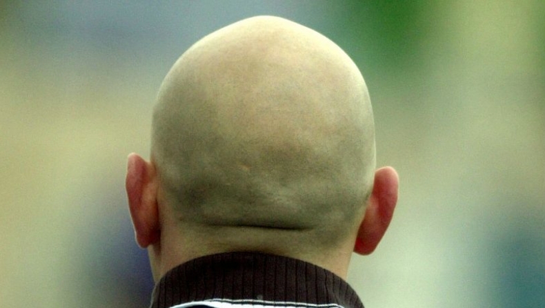 Τέλος στη φαλάκρα: Επιστήμονες δημιούργησαν ανθρώπινο δέρμα με τρίχες