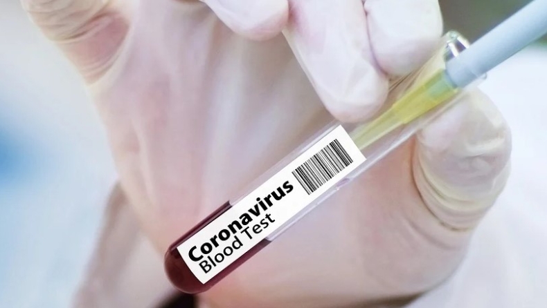 Κορονοϊός: «Η πανδημία ξεκινά μόλις τώρα», προειδοποιεί κορυφαίος λοιμωξιολόγος