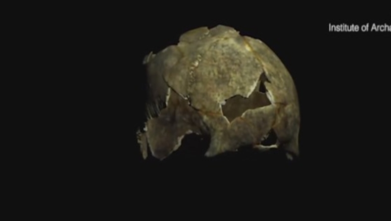 Βρέθηκε κρανίο που είχε υποβληθεί σε εγχείρηση εγκεφάλου πριν 5.000 χρόνια! (vid)