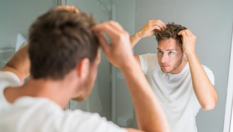 Τριχόπτωση: Πότε απαιτείται μεταμόσχευση μαλλιών;
