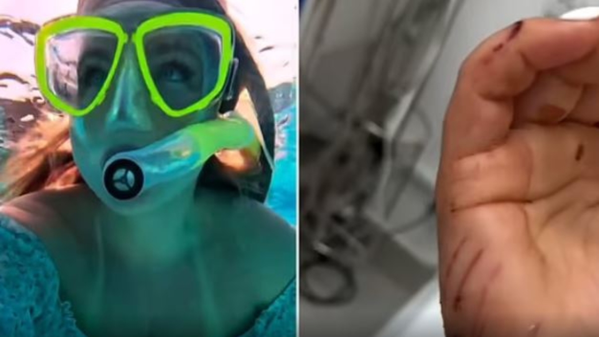 Βίντεο που «κόβει» την ανάσα: Influencer δέχθηκε επίθεση από καρχαρία την ώρα που έκανε live