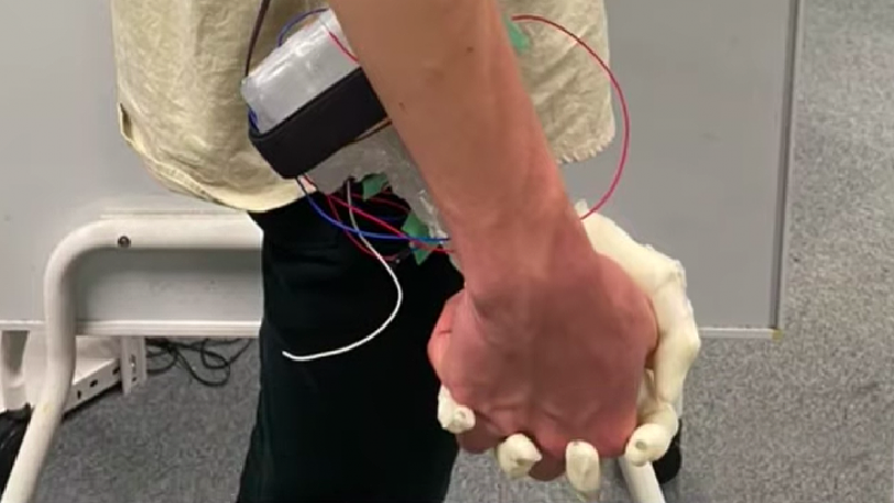 Έφτιαξαν γυναικείο ρομποτικό χέρι για μοναχικούς άντρες