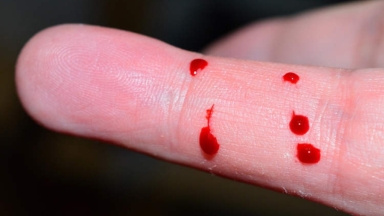 Ρωσία: 17χρονος κατέληξε στο νοσοκομείο αφού ήπιε το αίμα του για να «ανεβάσει» σίδηρο