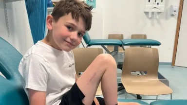 Επανάσταση στην ιατρική: Μεγάλωσαν κατά 3 εκατοστά το πόδι ενός αγοριού με πρωτοποριακή επέμβαση